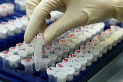 Ministerstvo chce usměrnit pravidla nakládání se vzorky DNA, policie by je mohla odebrat i dětem