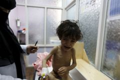 V Jemenu umírá každých 10 minut dítě, země směřuje k masivnímu hladomoru, varuje expert z OSN