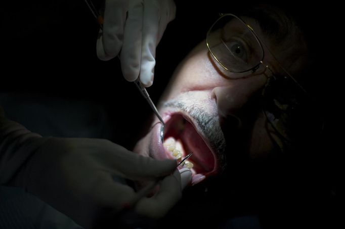 A dentist cleans a patients teeth at the Remote Area Medical (RAM) clinic in Wise, Virginia July 20, 2012. RAM clinics bring free medical, dental and vision care to uninsured and under-insured people across the country and abroad. The Wise clinic was the 647th RAM expedition since 1985 and drew 1700 patients from 14 states, organizers said. Picture taken July 20, 2012. REUTERS/Mark Makela (UNITED STATES - Tags: HEALTH SOCIETY) Published: Čec. 24, 2012, 3:07 odp.