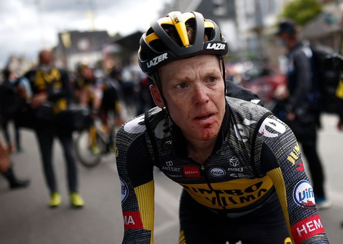 3. etapa Tour de France 2021: Zkrvavený Steven Kruijswijk.