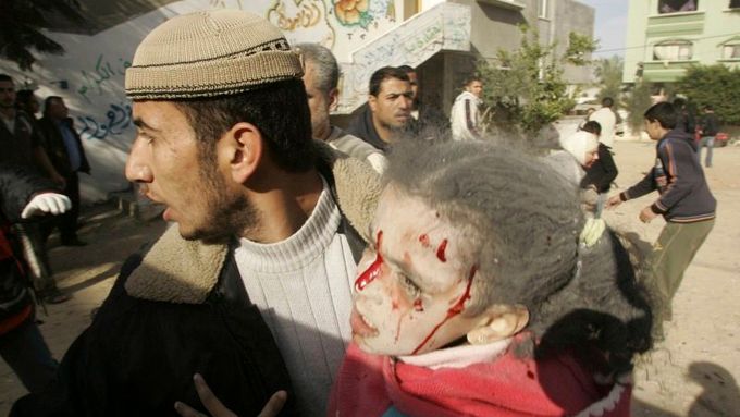 Medik odnáší zraněnou palestinskou dívku k ošetření. Město Džabalíja, Gaza.
