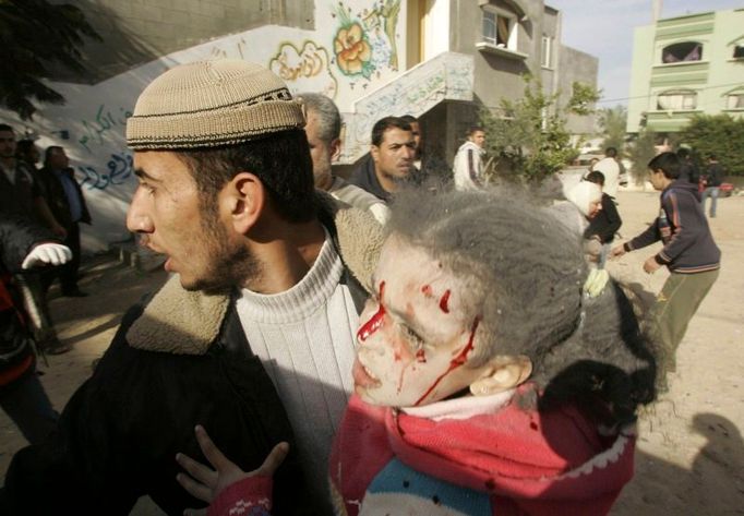 Medik odnáší zraněnou palestinskou dívku k ošetření. Město Džabalíja, Gaza.