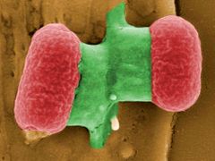 Loni vyvolala v Německu i zbytku Evropy paniku epidemie způsobená enterohemoragickou bakterií E.coli.
