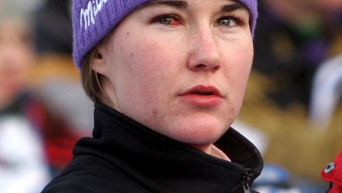 Zraněné oko Šárky Záhrobské opravdu nevypadalo pěkně. Přesto se nejlepší česká sjezdařka postavila na start víkendových závodů Světového poháru ve Špindlerově Mlýně.