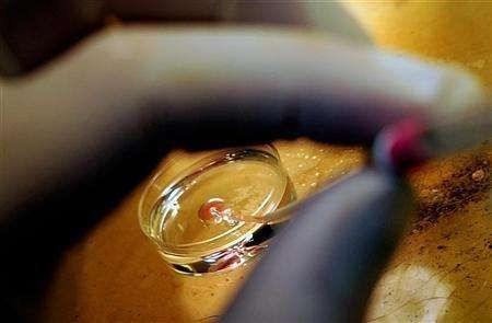 Lékař připravuje vajíčko na umělé oplodnění.
