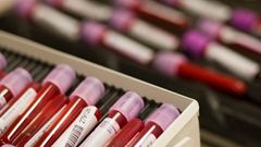 Doping, krevní testy, ampule s krví, Lausanne