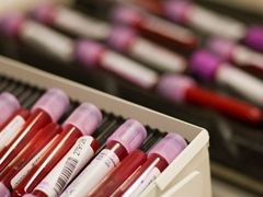Ampule s krevními vzorky sportovců čekají na rozbor ve švýcarské analytické laboratoři v Lausanne, která se specializuje na odhalování dopingu.