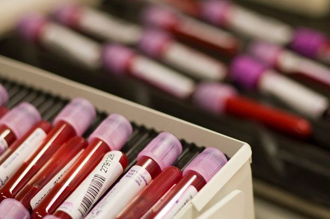 Ampule s krevními vzorky sportovců čekají na rozbor ve švýcarské analytické laboratoři v Lausanne, která se specializuje na odhalování dopingu.