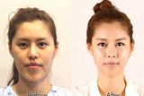 Snímky pacientů před a po operaci.