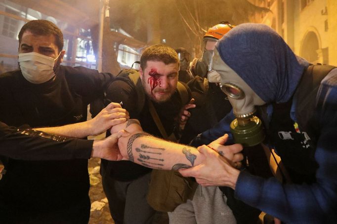 Jeden ze zraněných demonstrantů v Tbilisi.