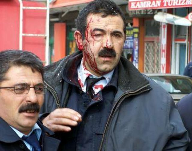 Kurdské nepokoje v Turecku