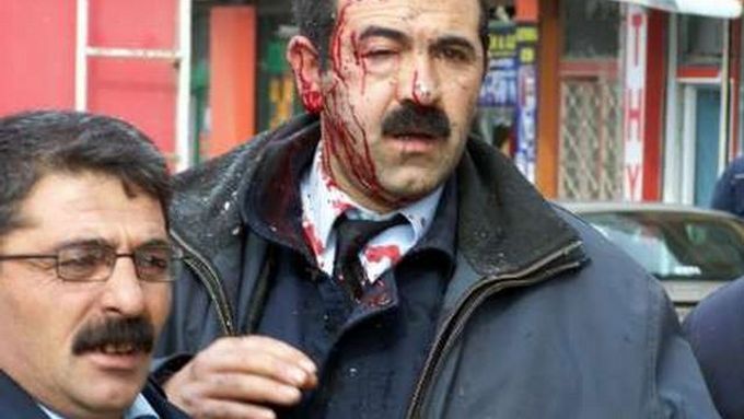 Muž, zraněný při explozi bomby ve východotureckém městě Van