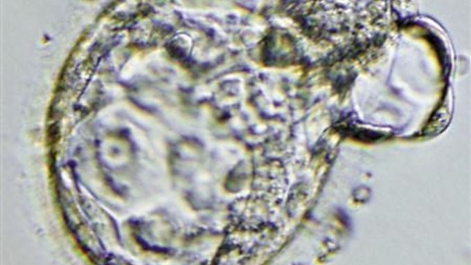 Klonované embryo na snímku společnosti Stemagen.