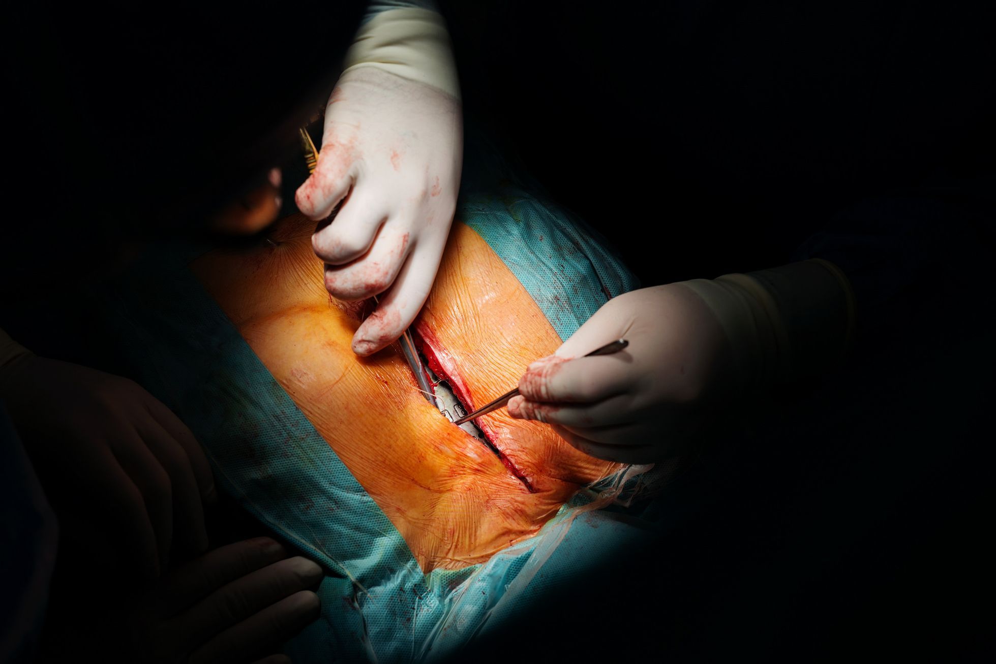 Igor Stančík: Fotografie z operačního sálu