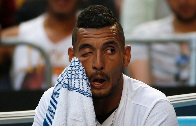 Australian Open, den první (Nick Kyrgios