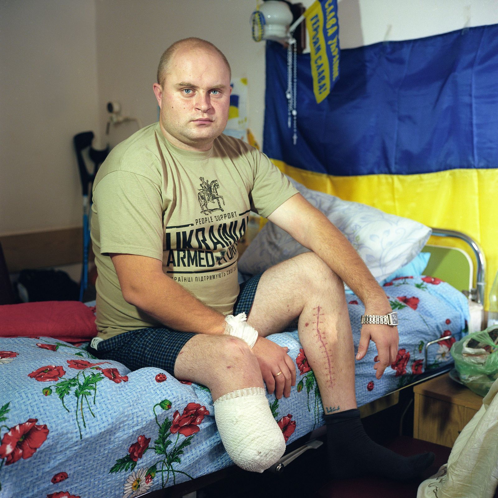 Ukrajina-zranění 11