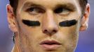 New England Patriots quarterback Tom Brady takes his helmet off during warm-ups ahead of the start of the NFL Super Bowl XLIX football game against the Seattle Seahawks i