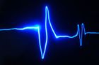Na Zlínsku se nejčastěji umírá na nemoci srdce a cév