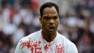 Zakrvácený Joleon Lescott během přátelského fotbalového utkání Anglie - Belgie.