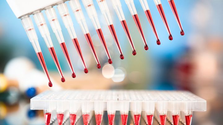 Belgický soud potvrdil nároky firmy Diag Human vůči Česku, to se chce odvolat