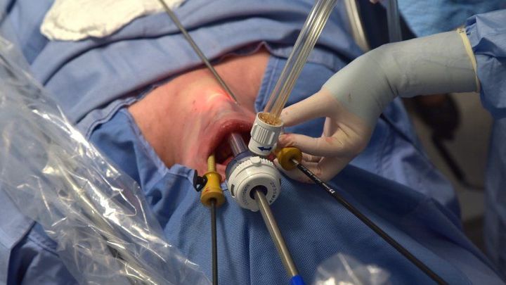 Brněnští lékaři poprvé v Česku operovali štítnou žlázu přes dolní ret