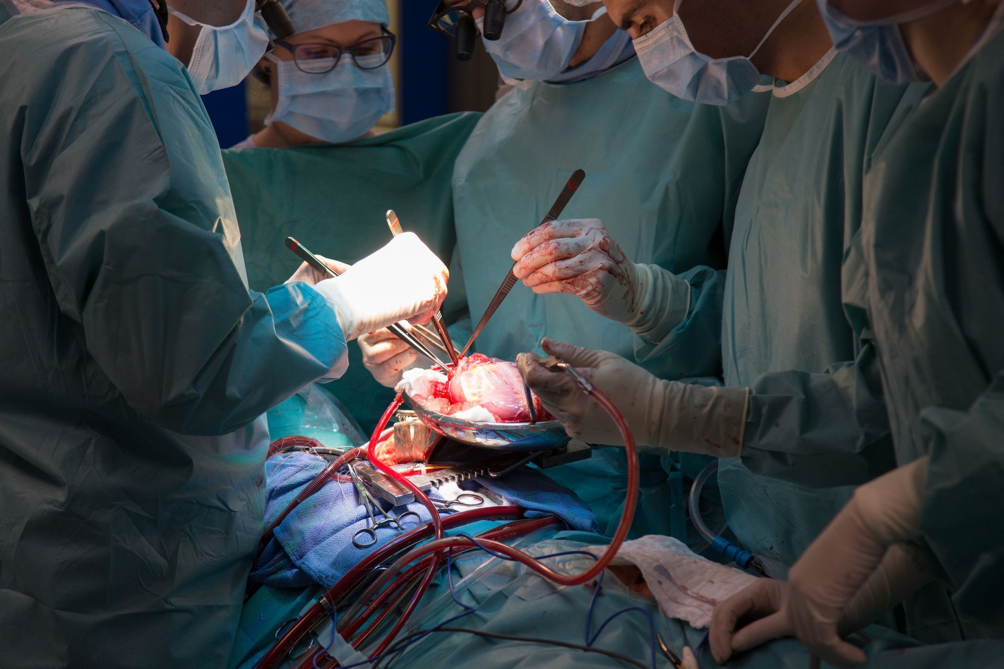 IKEM - 35 let od první transplantace srdce