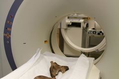 Radiologové prozkoumali skelet Tychona Brahe