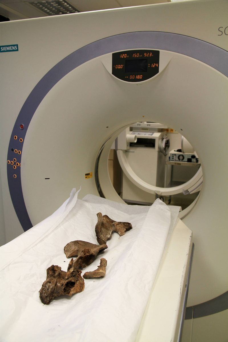 Radiologové prozkoumali skelet Tychona Brahe