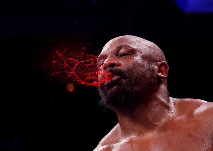 Zraněný Derek Chisora v zápase o titul šampiona WBC s Tysonem Furym