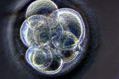 Přišel čas povolit genetické modifikace embryí, vyzývá sdružení expertů, etiků a politiků