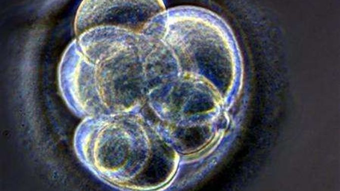 Lidský zárodek vzniklý spojením vajíčka a spermie ve zkumavce.