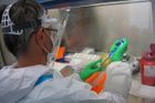 Tým vědců z centra BIOCEV ve spolupráci s dalšími institucemi rychle zavedl metody umožňující spolehlivou detekci viru SARS-CoV-2.
