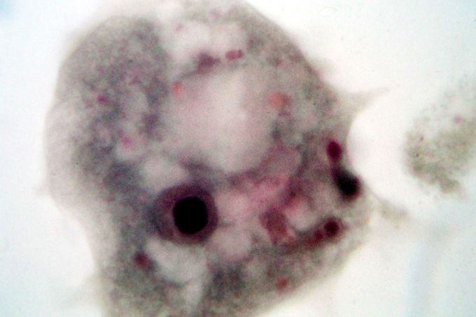 Velká améba připomínající rod Mayrorella. Snímek z mikroskopu.