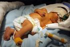 Dítě zemřelo při porodu doma. Hazard, zlobí se lékaři
