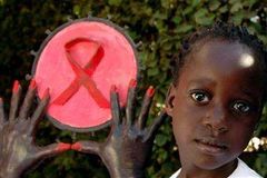 Virus HIV "předělává" lidské buňky