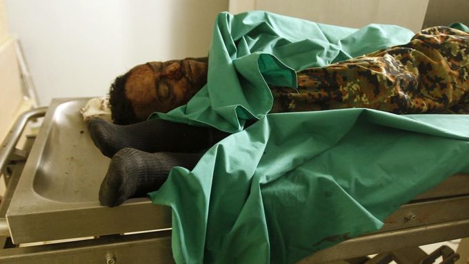 Oběti útoku sebevraha v nemocnici v Saná.
