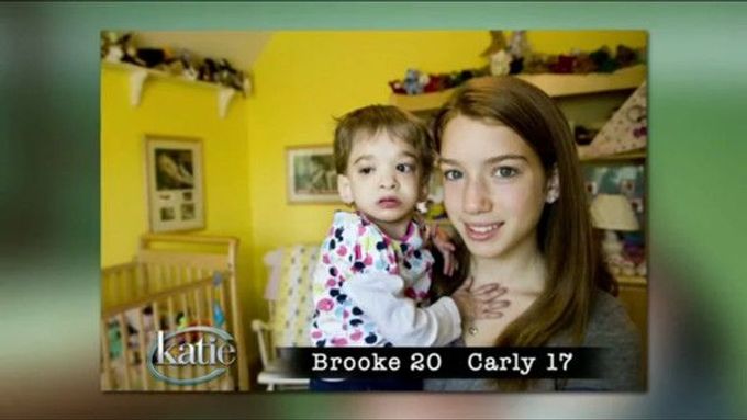 Zemřela Američanka Brooke Greenbergová, jejíž vzácné nemoci se někdy říká syndrom X.