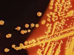 Bakterie E.coli.