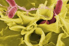 Hygienici: Za epidemii salmonely v Plzni mohly špagety