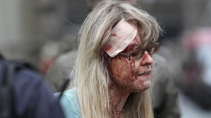 Zraněná žena po výbuchu v Praze.