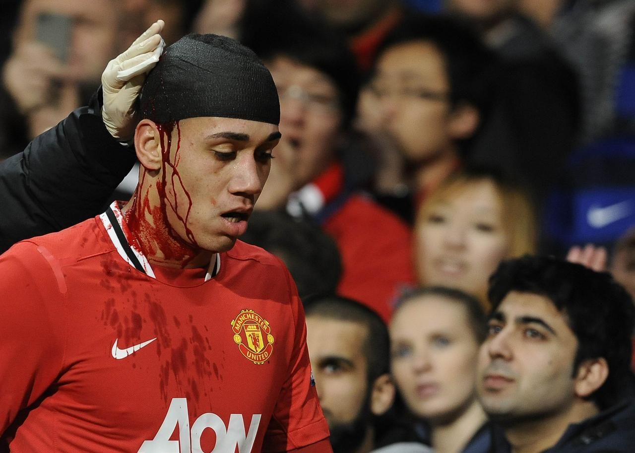 Chris Smalling (zranění v Evropské lize)