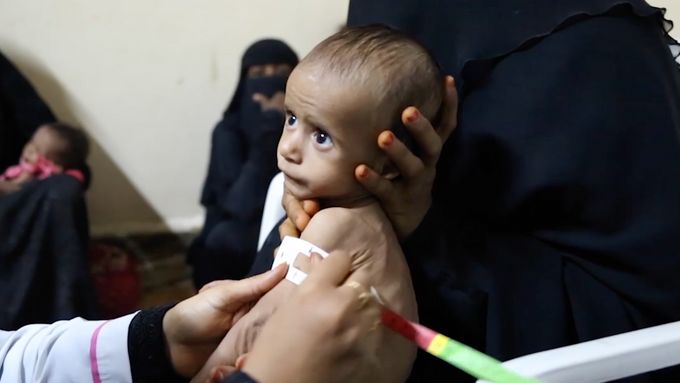 Humanitární krize v Jemenu - ilustrační foto.