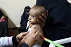 "Co je to cholera?" Jemen ničí epidemie i hladomor, lékaři v rozbitých nemocnicích nedostávají plat