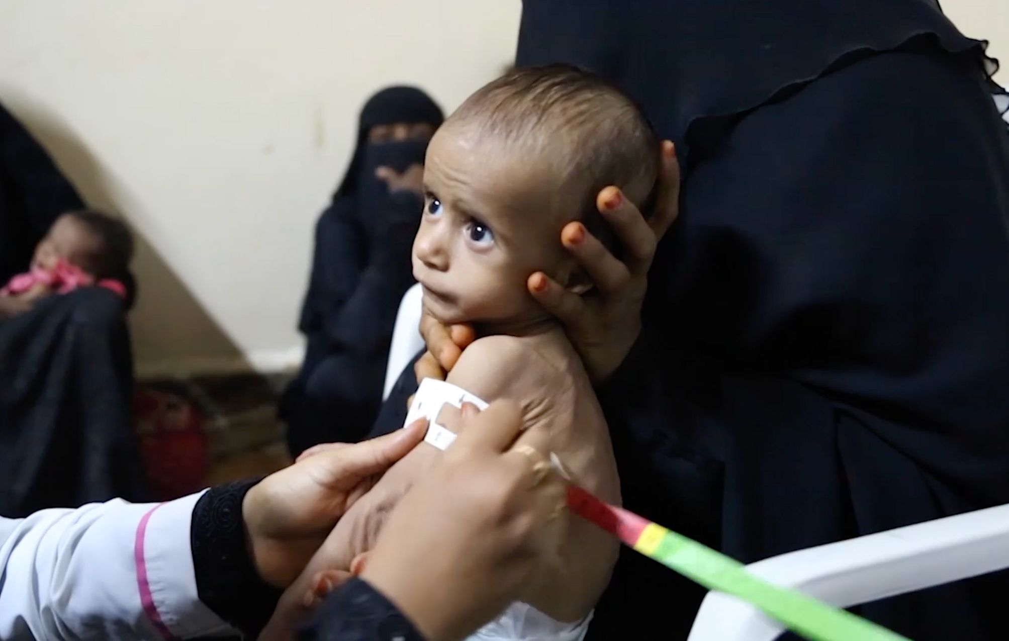 Tragická humanitární situace v Jemenu
