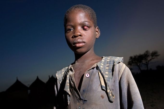 Třetí cena za sérii Hladové sny, Burkina Faso, červenec 2008