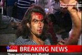 Zraněný muž po výbuších v indické Bombaji.