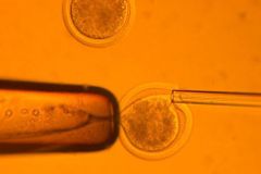 Klonování lidských buněk: Kdy půjde opravovat člověk?