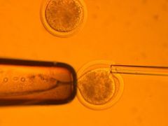 Klonování, neboli výměna buněčných jader v savčím vajíčku pod mikroskopem.