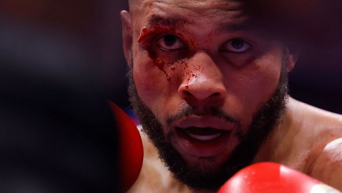 Chris Eubank junior dokončil zápas doslova zalitý krví.