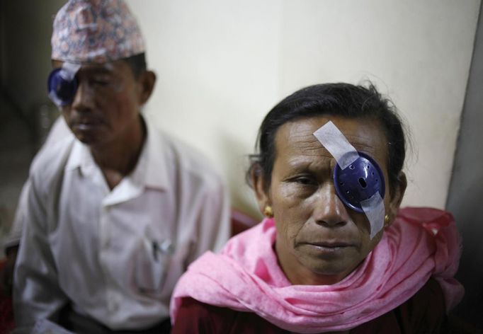 Patients with cataract wait to change their eye dressings after undergoing surgeries to remove their cataracts at the Tilganga Eye Center in Kathmandu April 27, 2012. About 150,000 of Nepal's 26.6 million people are estimated to be blind in both eyes, most of them with cataracts. Picture taken April 27, 2012. REUTERS/Navesh Chitrakar (NEPAL - Tags: HEALTH SOCIETY POVERTY) Published: Kvě. 2, 2012, 4:36 dop